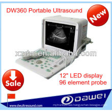 portable Ultrasound price